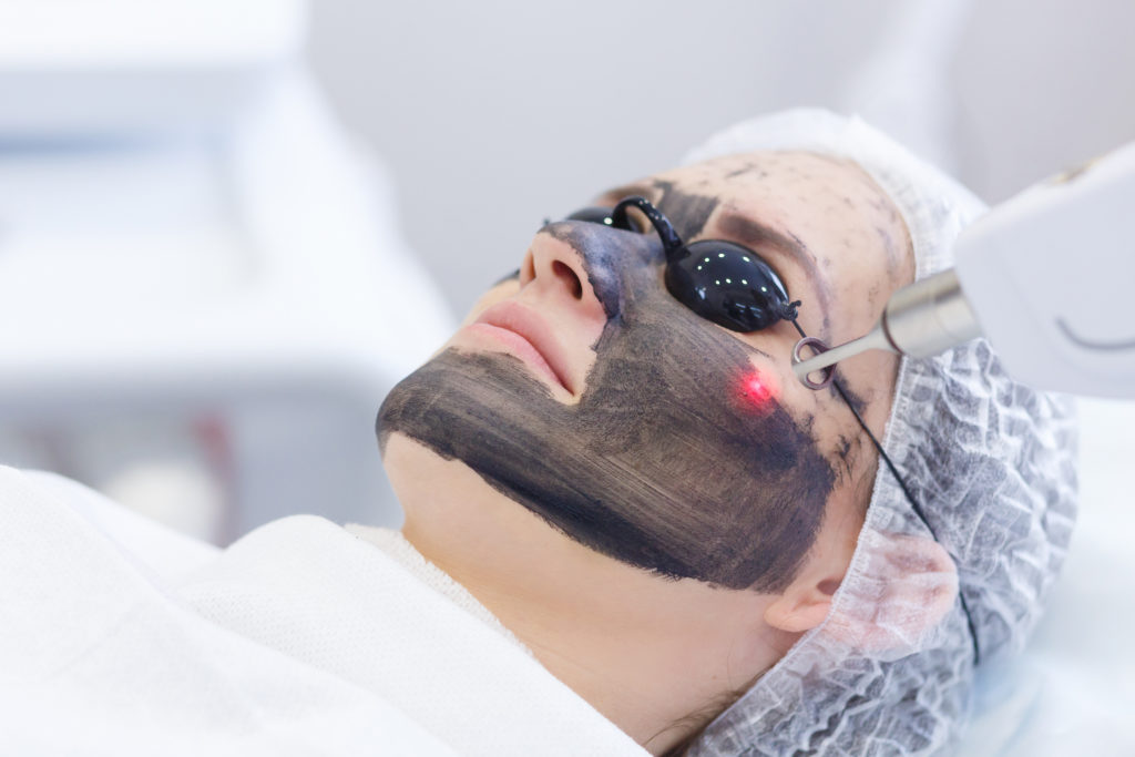 What is Aviclear LASER , and how does it work