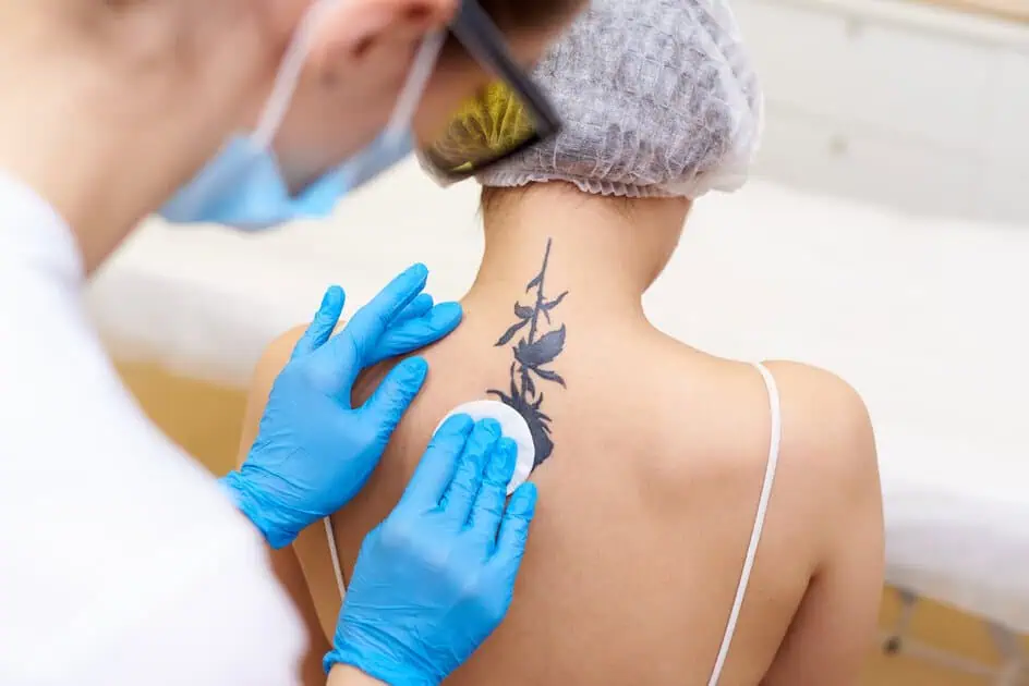 Tattoo Removal by Truth Med Spa in Lakewood, CO