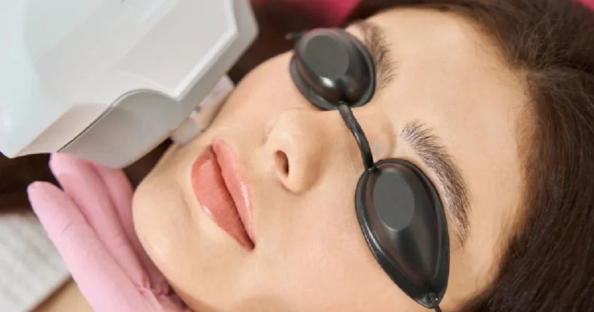 Women receiving IPL Treatments Lakewood, CO