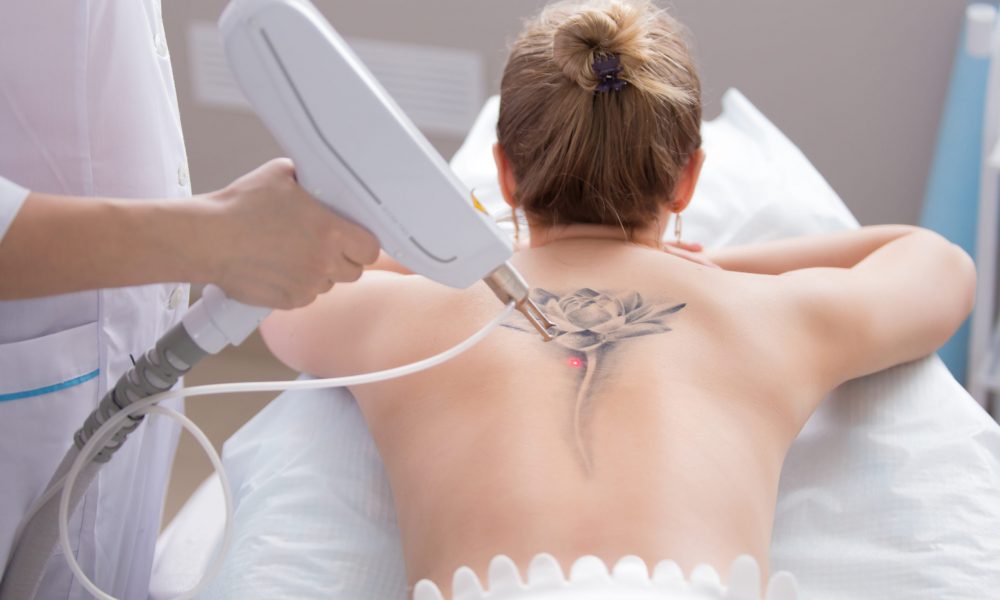 Health Implications Of Tattoo Removal Is It Safe