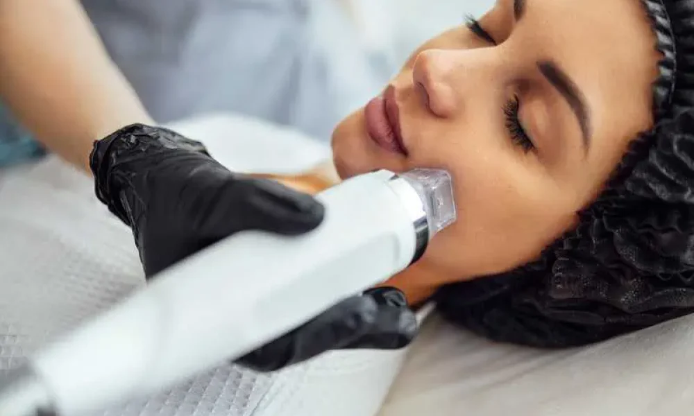 RF Microneedling by Truth Med Spa in Lakewood CO