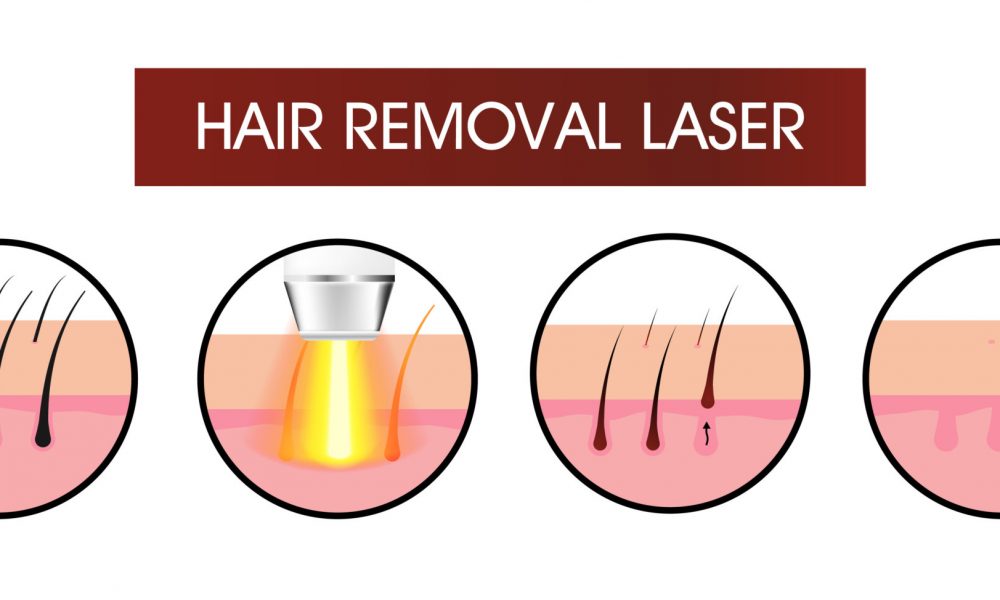 FAQs You Should Know Before Going For Laser Hair Treatment | Truth MedSpa